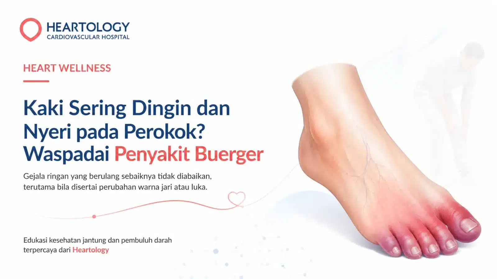 Ilustrasi medis kaki dengan sorotan merah lembut pada jari kaki yang menggambarkan tanda kewaspadaan Penyakit Buerger, seperti gangguan aliran darah atau keluhan pada area distal kaki.