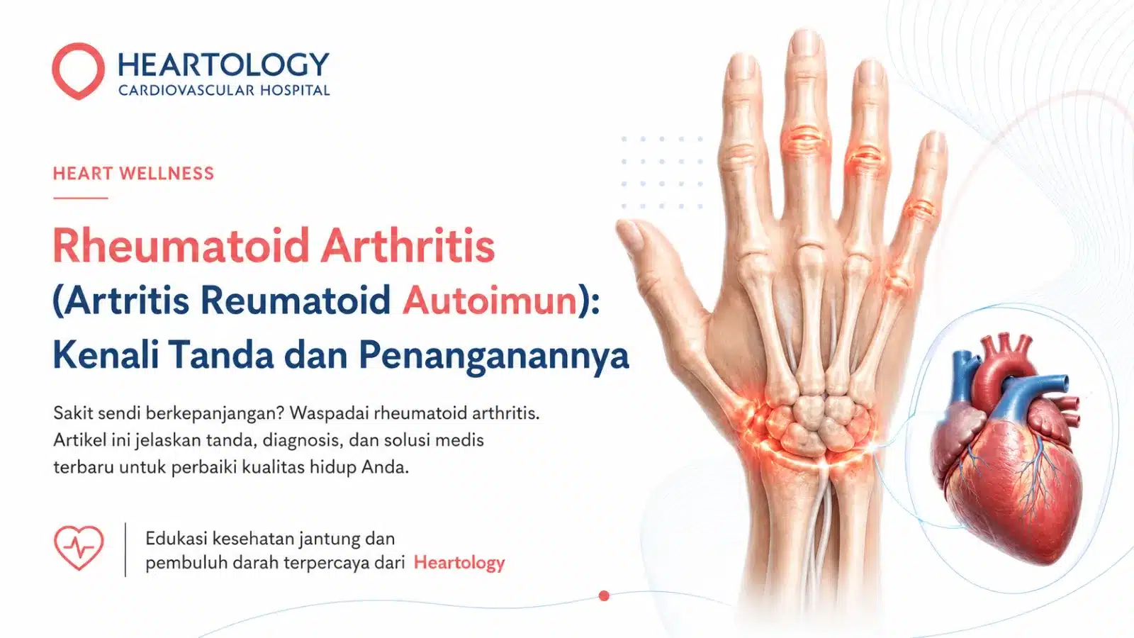Ilustrasi rheumatoid arthritis pada sendi tangan dengan visual jantung dan pembuluh darah untuk edukasi kaitannya dengan kesehatan kardiovaskular.