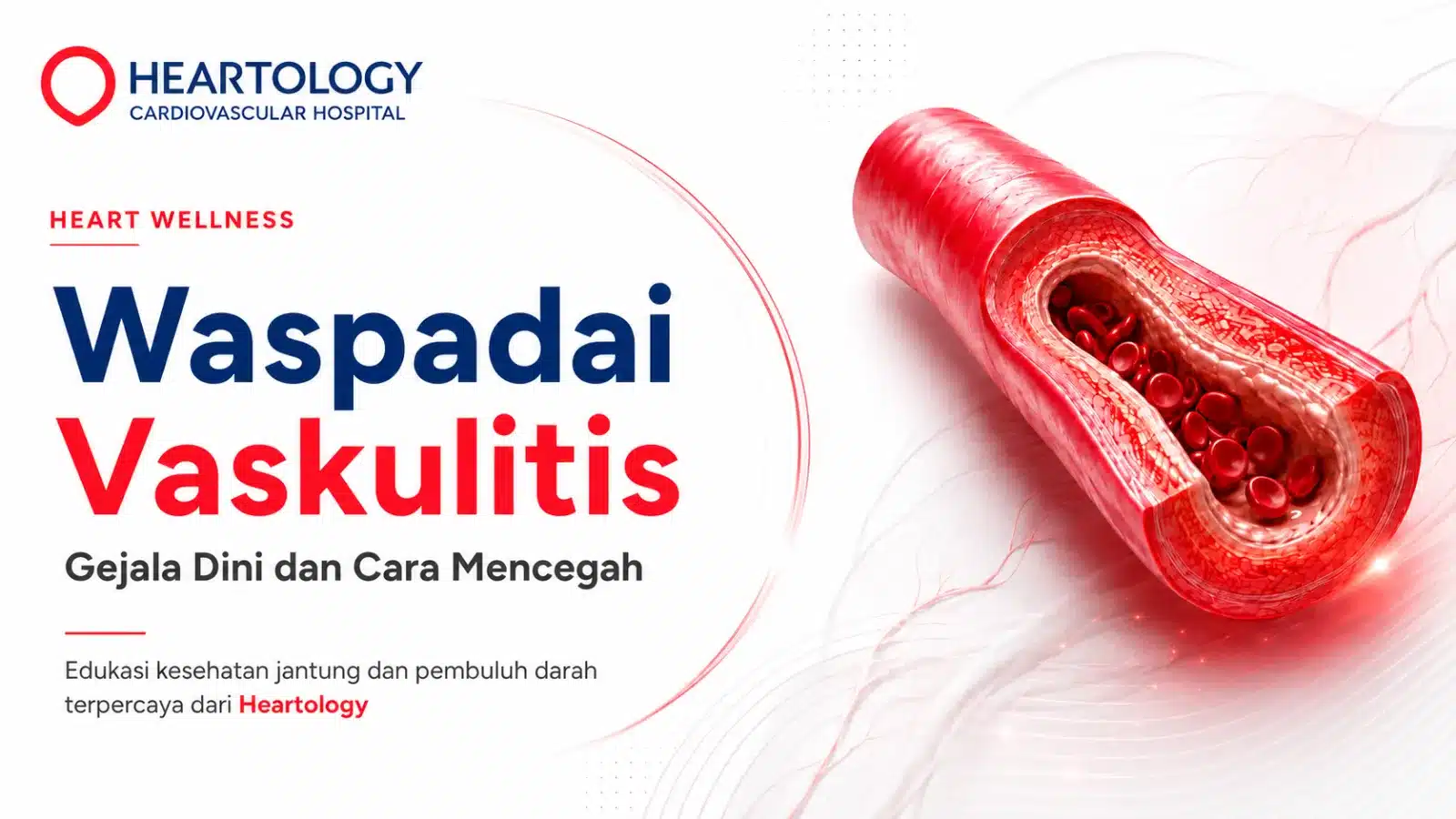 Waspadai Vaskulitis: Gejala Dini & Cara Mencegah