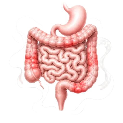 Ilustrasi penyakit Crohn dengan visual saluran pencernaan dan penjelasan gejala, penyebab, serta pengobatan dari Heartology.