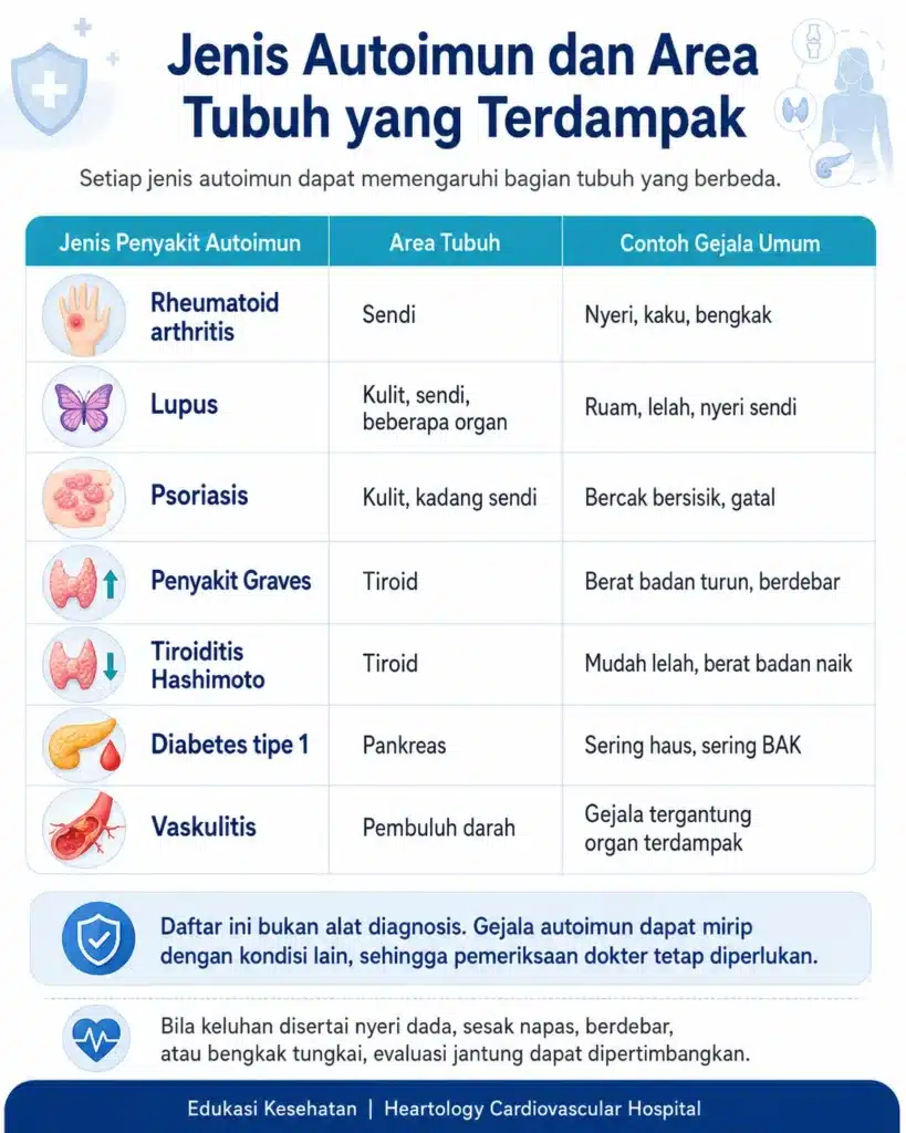 Infografis tabel jenis autoimun dan area tubuh yang terdampak, menampilkan rheumatoid arthritis pada sendi, lupus pada kulit dan organ, psoriasis pada kulit, penyakit Graves dan Hashimoto pada tiroid, diabetes tipe 1 pada pankreas, serta vaskulitis pada pembuluh darah.