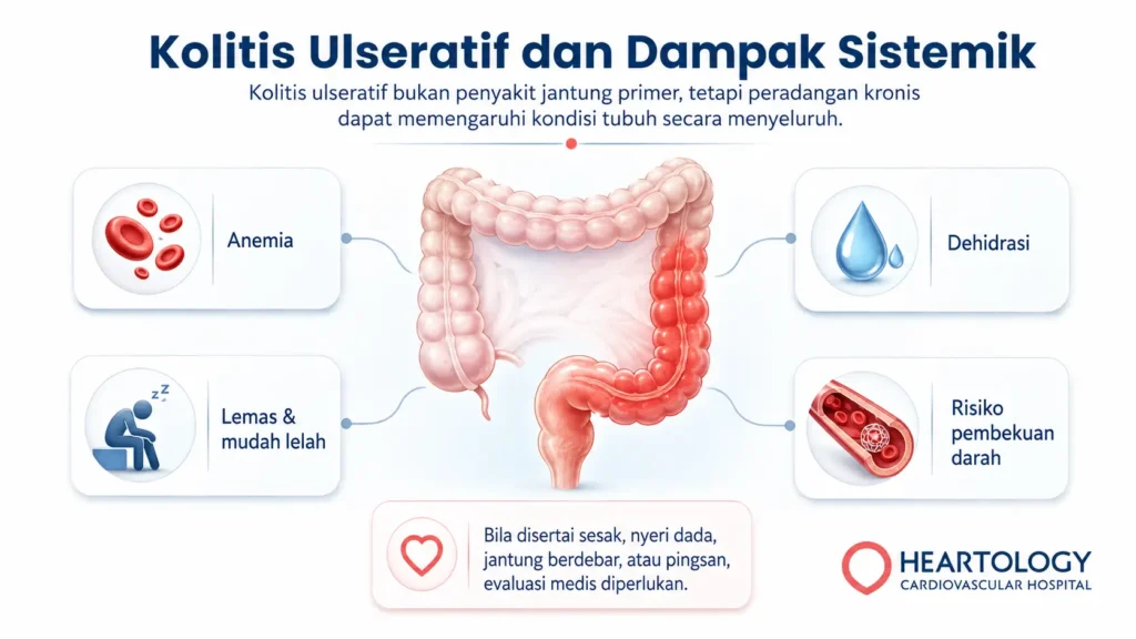 Infografik medis Heartology tentang kolitis ulseratif dan dampak sistemik pada tubuh, menampilkan usus besar yang meradang dengan penjelasan risiko anemia, dehidrasi, lemas atau mudah lelah, serta risiko pembekuan darah.