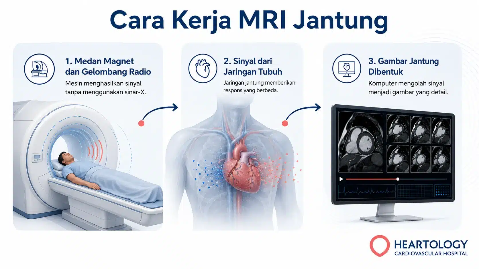 Infografik cara kerja MRI jantung, mulai dari penggunaan medan magnet dan gelombang radio hingga pembentukan gambar detail jantung oleh komputer.