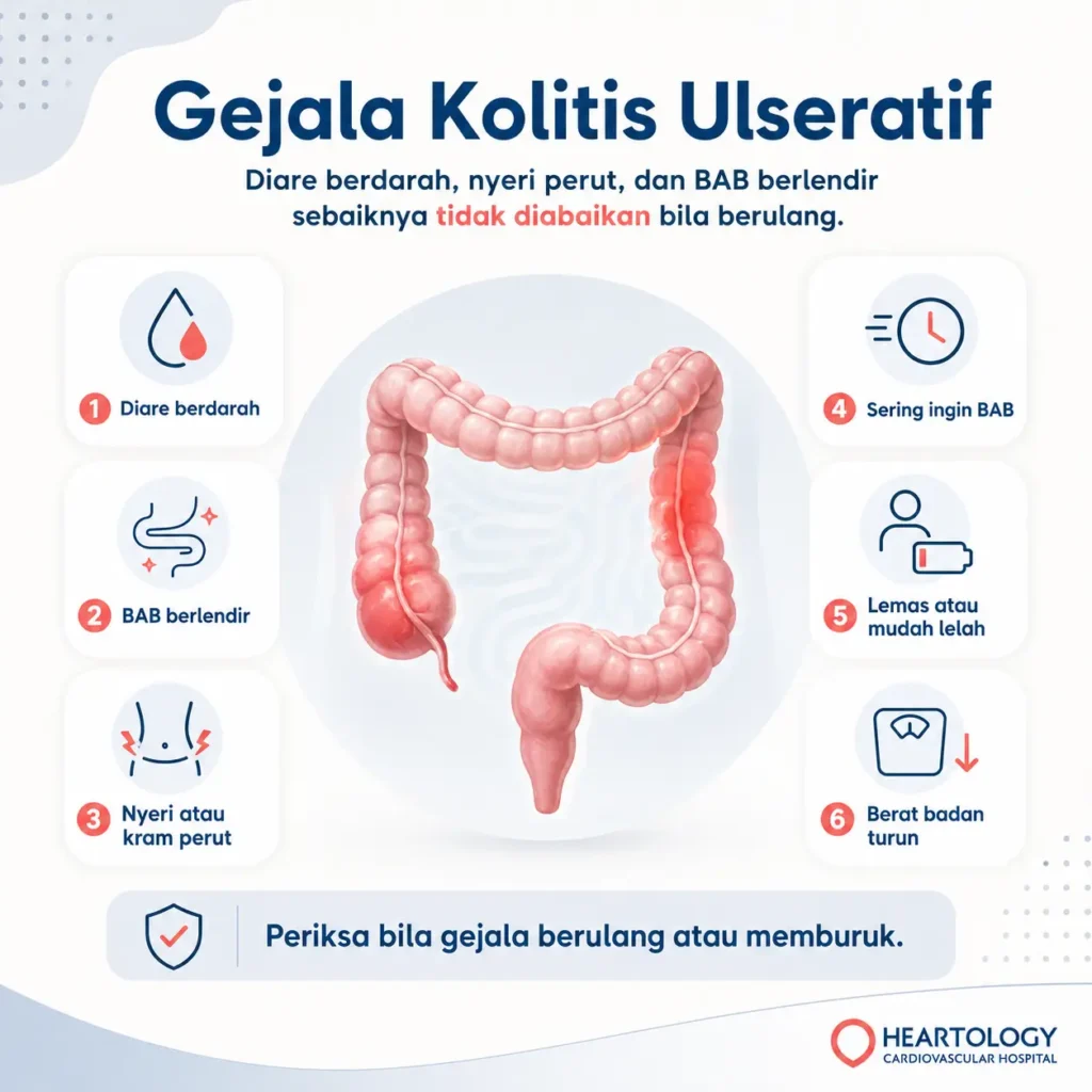 Infografis medis Heartology berjudul gejala kolitis ulseratif yang perlu diperhatikan, menampilkan ilustrasi usus besar dan enam gejala utama: diare berdarah, BAB berlendir, nyeri atau kram perut, sering ingin BAB, lemas atau mudah lelah, serta berat badan turun.