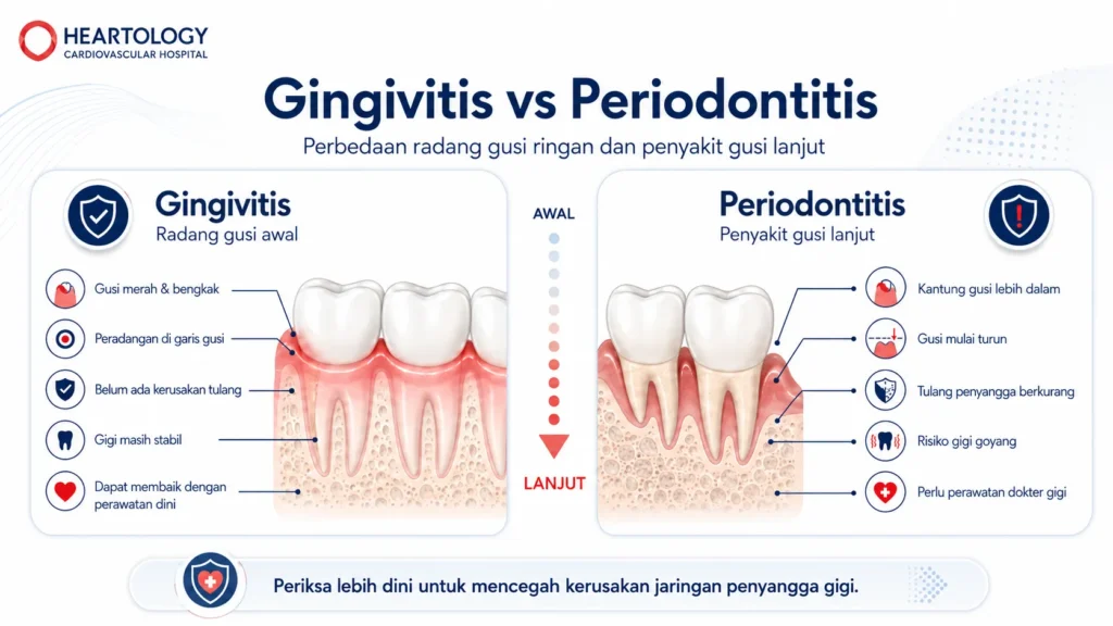 Infografik Gingivitis vs Periodontitis dari Heartology yang menunjukkan perbedaan radang gusi awal dan penyakit gusi lanjut, termasuk gusi merah dan bengkak, kantung gusi lebih dalam, penurunan gusi, berkurangnya tulang penyangga, serta perlunya perawatan dini dan pemeriksaan dokter gigi.