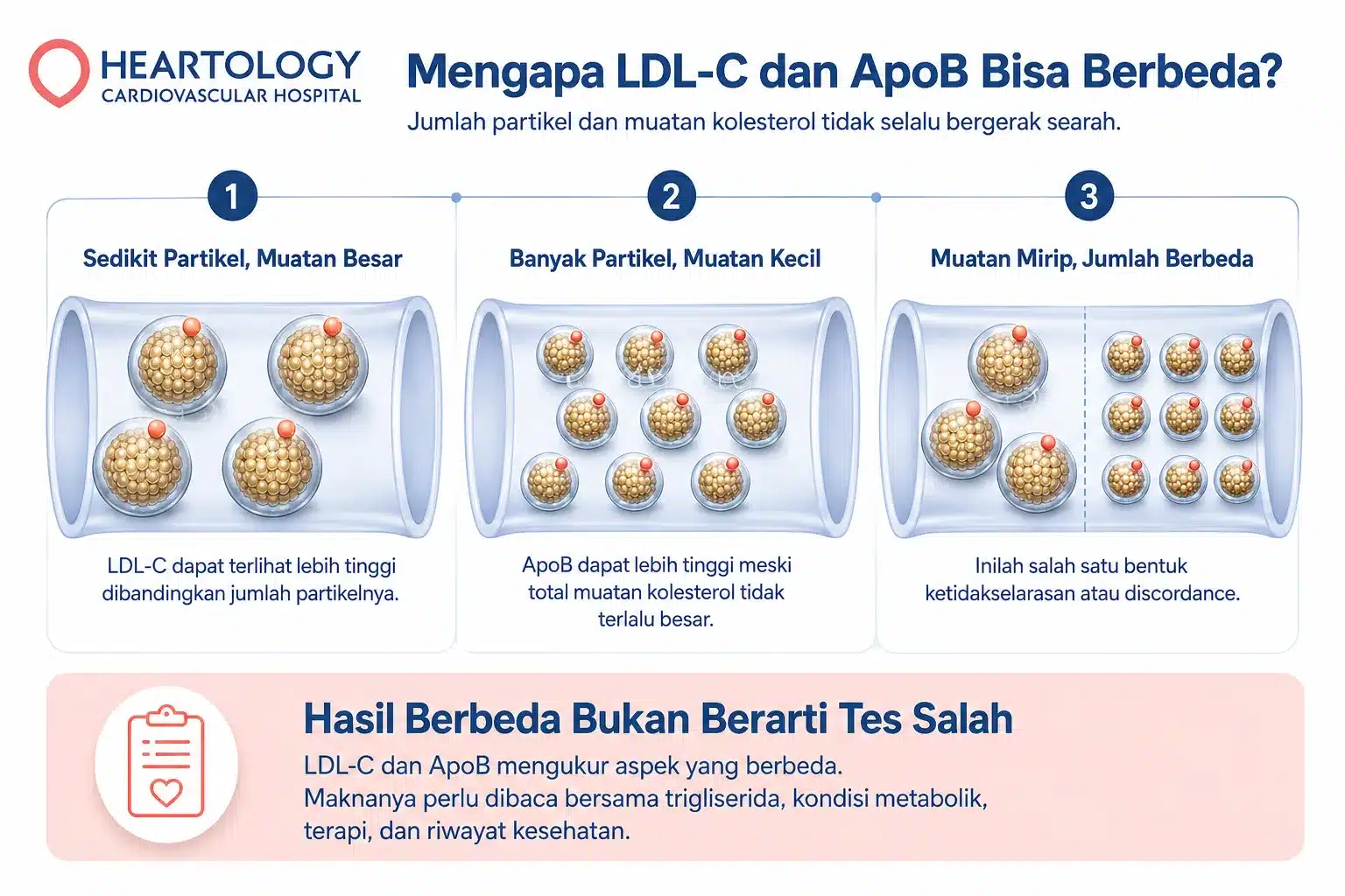 Infografik medis Heartology tentang perbedaan LDL-C dan ApoB, menampilkan tiga skenario jumlah partikel lipoprotein dan muatan kolesterol yang tidak selalu bergerak searah.