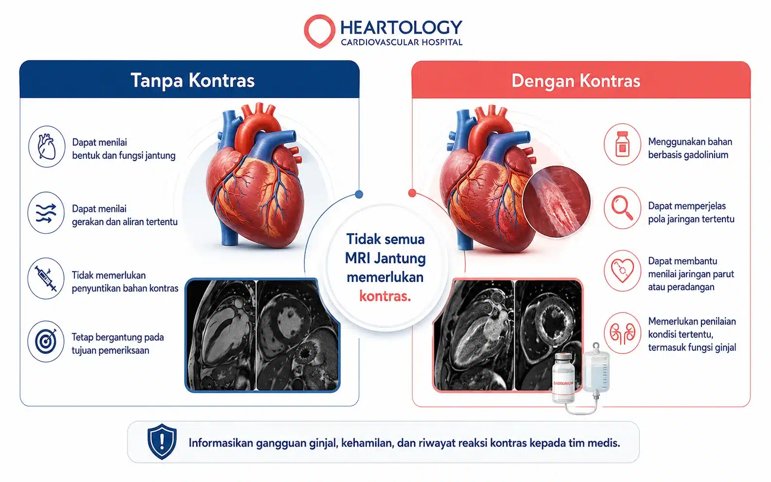 Infografik perbedaan MRI jantung dengan dan tanpa kontras, meliputi fungsi pemeriksaan, penggunaan gadolinium, penilaian jaringan jantung, dan pertimbangan fungsi ginjal.