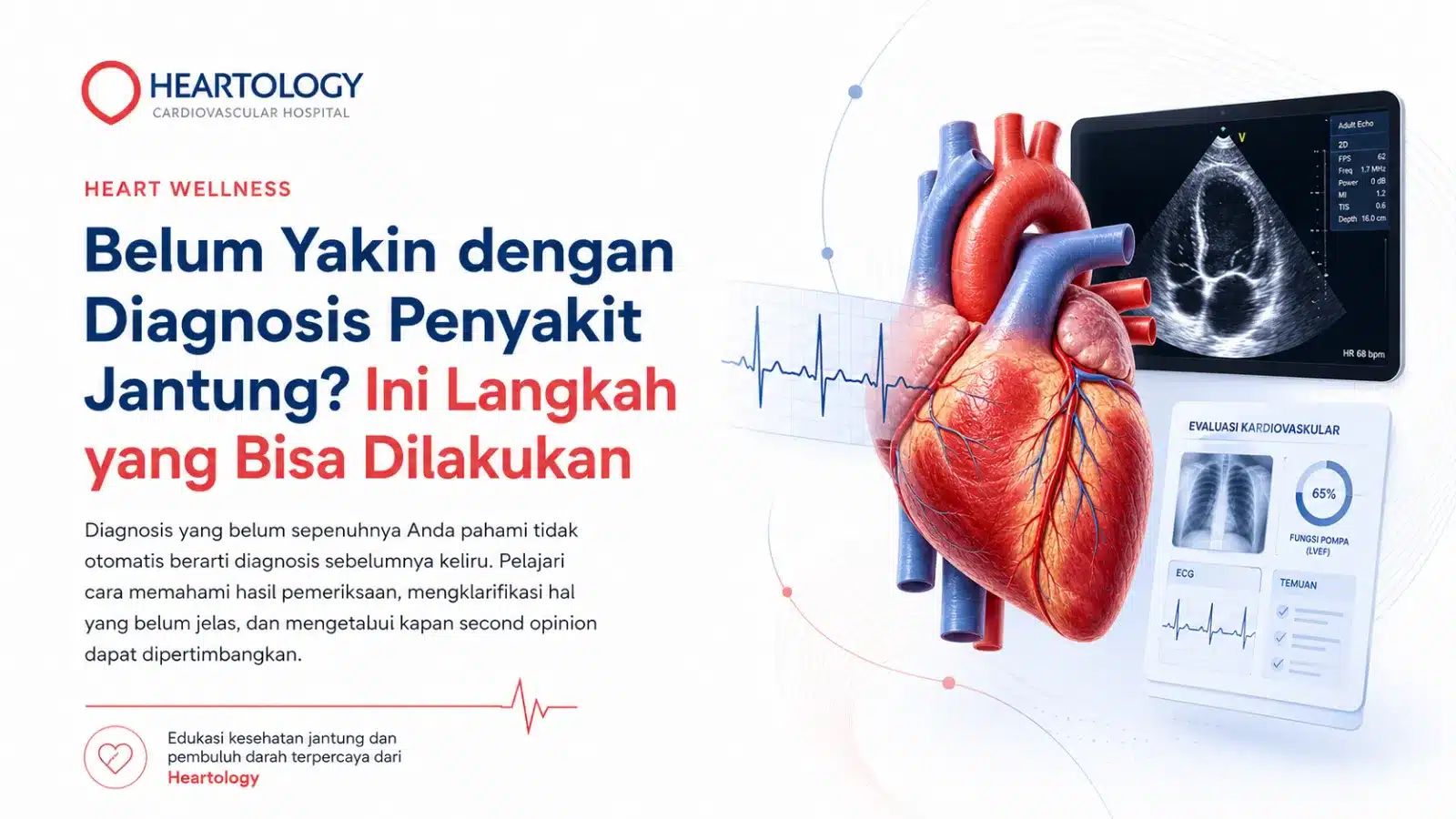 Belum Yakin dengan Diagnosis Penyakit Jantung? Ini Langkah yang Bisa Dilakukan