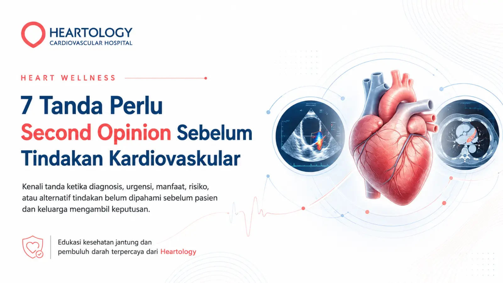 7 Tanda Perlu Second Opinion Sebelum Tindakan Kardiovaskular