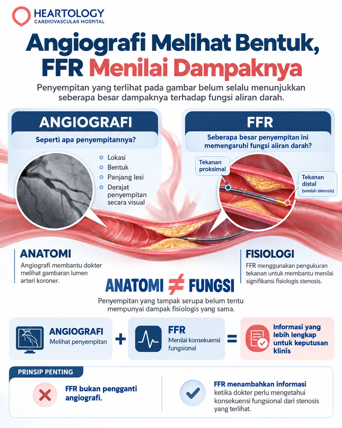Infografik Heartology tentang perbedaan angiografi dan FFR jantung, menampilkan penyempitan arteri koroner, gambaran angiografi, serta pressure wire untuk menilai dampak fisiologis stenosis terhadap aliran darah.